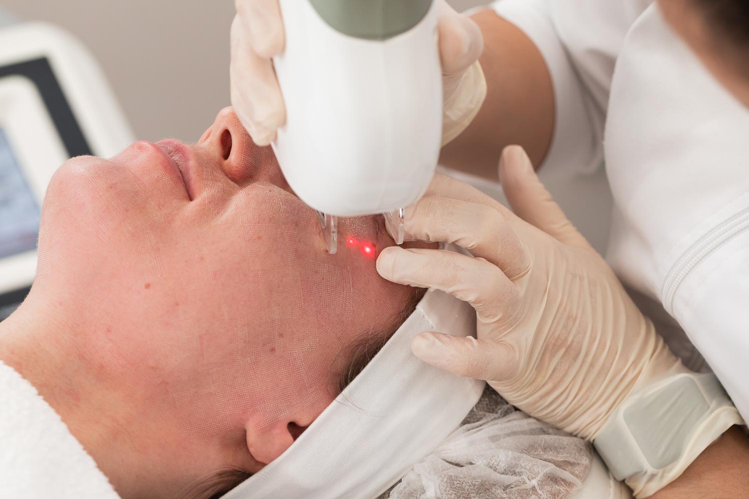 Laser Treatments - Dermotique Skin & Laser Clinic